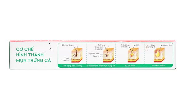 Kem Acnes Blemish Clear kháng khuẩn, giảm mụn sưng đỏ tuýp 10g